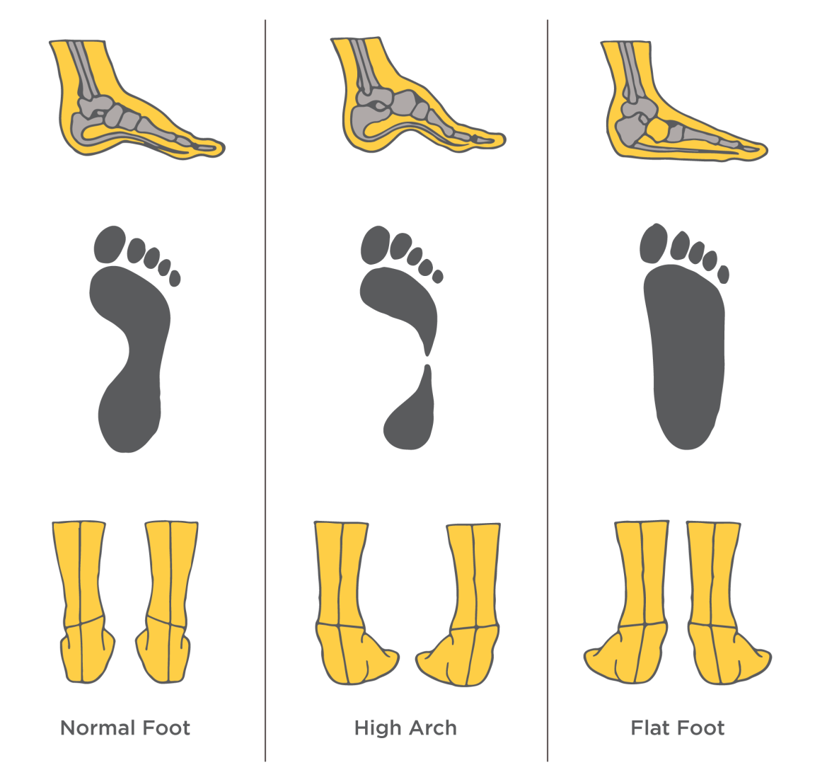 A Podiatrist’s Running Shoe Fit Guide: Assessing Arch, Gait, and Stride ...